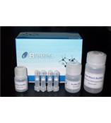 超薄柱型PCR产物纯化试剂盒(50preps)