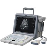 恩普便携式液晶全数字化超声诊断仪EMP-820PLUS