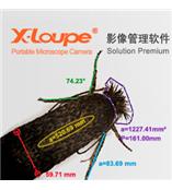 X-Loupe 影像管理软件 Solution  显微图像分析,显微图像分析软件,图像分析