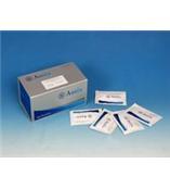 Y10002A	(ANG)人血管生长素Elisa试剂盒