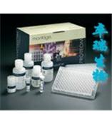 溶菌酶测试盒(带标准)/LZM测剂盒(带标准)     C0090