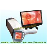 妇科疾病阴道镜检测仪