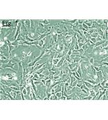 人脑血管周细胞