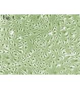 人脉络丛内皮细胞