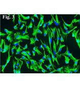 人脉络丛上皮细胞