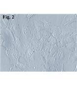 人脉络丛成纤维细胞