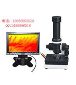 微循环检测仪 专业检测心脑血管 高血压 中风