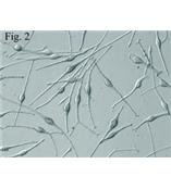 人表皮黑色素细胞--深色素