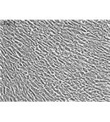 人真皮成纤维细胞--胎儿