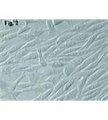 人真皮成纤维细胞--新生