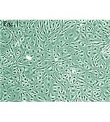 人视网膜内皮细胞