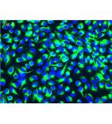 人视网膜色素上皮细胞