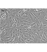 人晶状体上皮细胞
