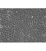 人虹膜色素上皮细胞