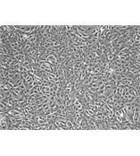 人无色素睫装上皮细胞