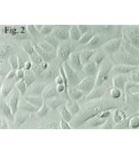 人膀胱平滑肌细胞