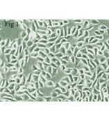 人尿道上皮细胞