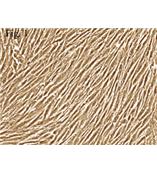 人绒毛间充质成纤维细胞