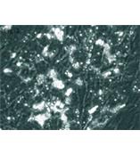 人脂肪细胞--内脏