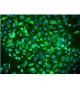 人卵巢表层上皮细胞