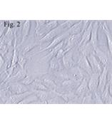 人间充质干细胞--脂肪