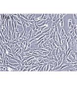 人脐带间充质干细胞