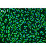 人脐静脉内皮细胞