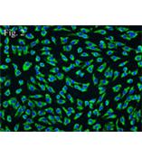 人脐动脉内皮细胞