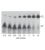 美国NEB公司 T4 多聚核苷酸激酶(T4 PNK)M0201L/M0201S