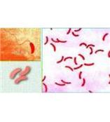 破傷風桿菌裝片的供應價格|組織胚胎顯微切片的供應商天呈南京