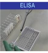 人CC趋化因子受体1 ELISA试剂盒促销