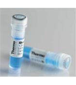 人肝铁蛋白(Ferritin)