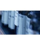 SYBR Green I ，荧光双标记引物产品，Cy3 NHS ester，2D DIGE荧光染料试剂盒