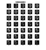 HT-MRSI60-35A 1.5T（35mm）核磁共振分子影像成像仪