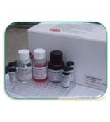 呋喃妥因代谢物快速检测试剂盒