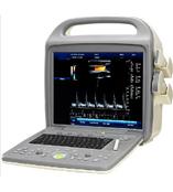 多普勒超声波诊断仪、多普勒彩超、手提式多普勒彩超.