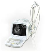 手提式B超、超声诊断仪、全数字高清B超