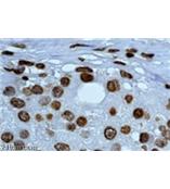 Y09-8B大流量激光尘埃粒子计数器