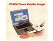 TiVi600光譜成像血流分析儀
