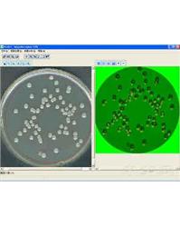 BioDit全自动菌落计数仪CFU-300