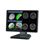 医疗影像显示器